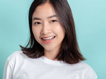 Why You Should Opt for Orthodontics