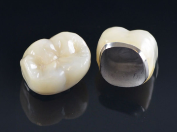 How Long Can You Expect a Molar Crown to Last?