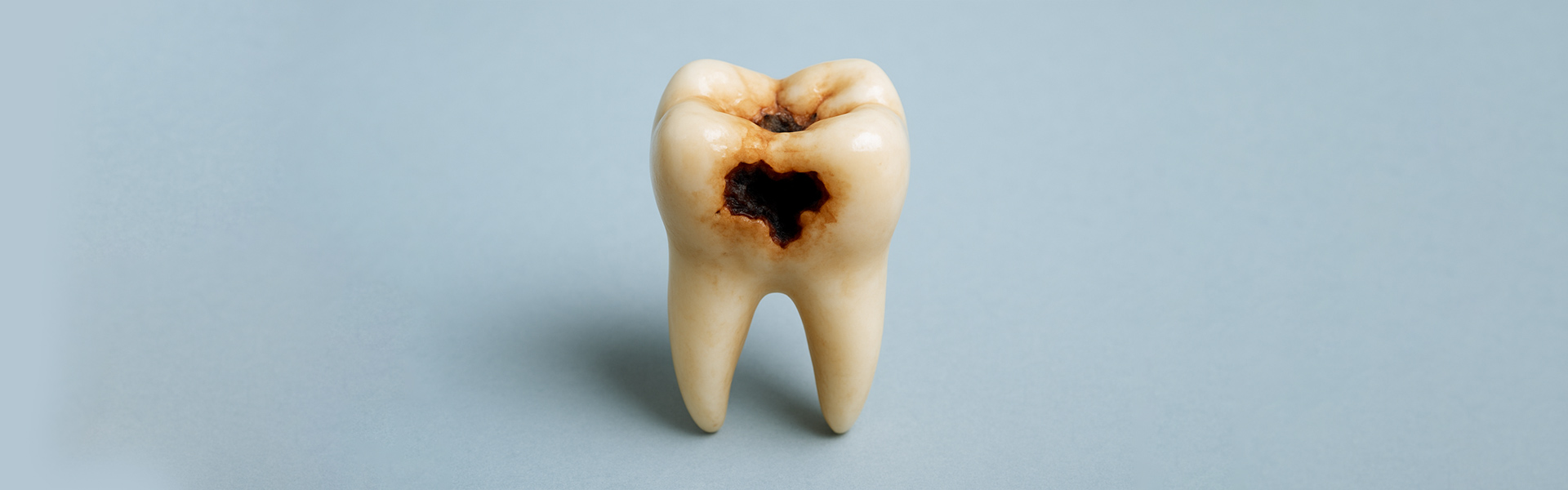 How Long Does It Take to Fill a Cavity? A Quick Guide