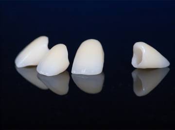 Can a Crown Improve the Appearance of a Discolored or Misshapen Tooth?
