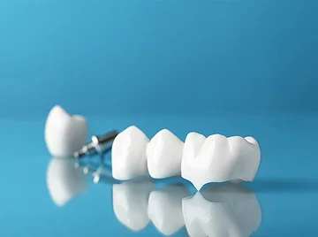 Is It Normal for a New Dental Crown to Feel Too High?